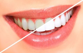 Dentistinas - odontologijos klinika Vilnius