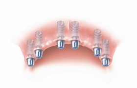 Dentistinas - odontologijos klinika Vilnius