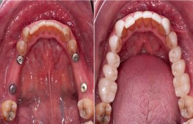Ozo estetinės odontologijos ir implantologijos klinika - odontologijos klinika Vilnius