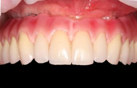 Dentida - odontologijos klinika Panevėžys