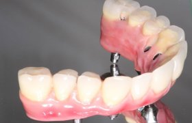 Dentida - odontologijos klinika Panevėžys