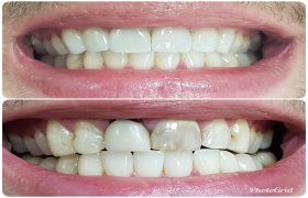 Dentaris - odontologijos klinika Šiauliai