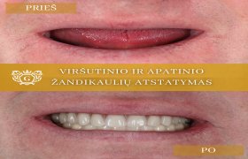 Glorydenta, odontologijos centras - odontologijos klinika Klaipėda
