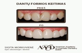 Prodentas, estetinės odontologijos klinika - odontologijos klinika Kaunas