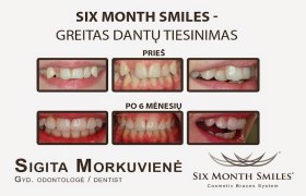 Prodentas, estetinės odontologijos klinika - odontologijos klinika Kaunas