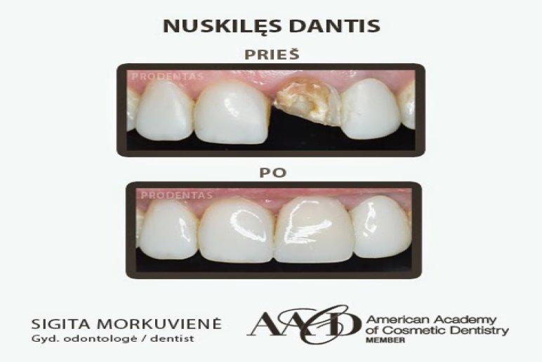 Prodentas, estetinės odontologijos klinika