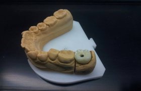 Šilainių odontologijos centras - odontologijos klinika Kaunas
