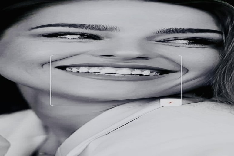 Albodent