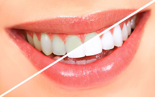 Dentistinas - odontologijos klinika Vilnius