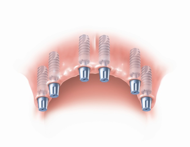 Dentistinas - odontologijos klinika Vilnius