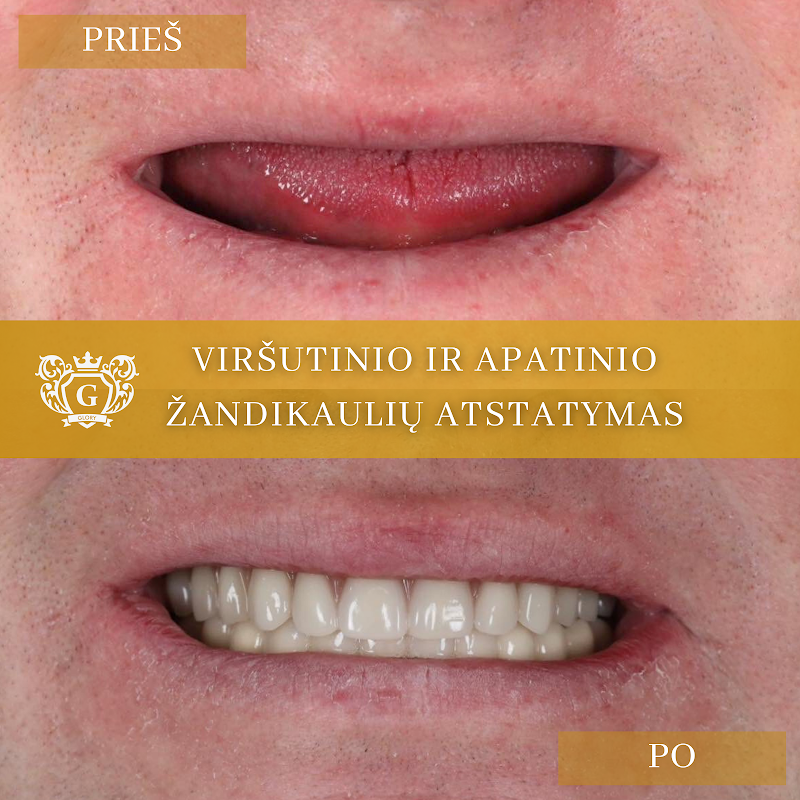 Glorydenta, odontologijos centras - odontologijos klinika Klaipėda