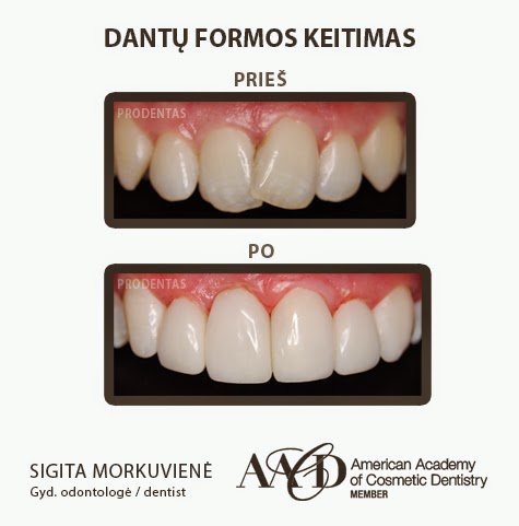 Prodentas, estetinės odontologijos klinika - odontologijos klinika Kaunas