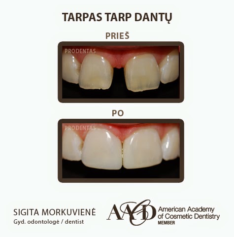 Prodentas, estetinės odontologijos klinika - odontologijos klinika Kaunas