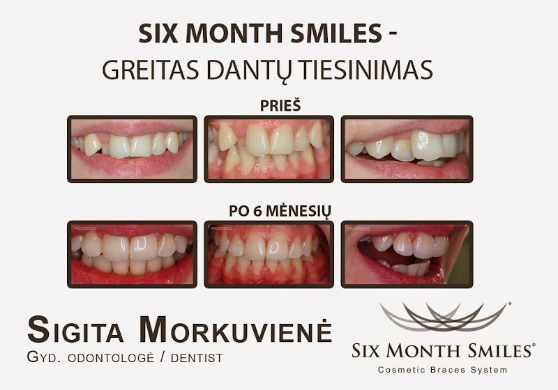 Prodentas, estetinės odontologijos klinika - odontologijos klinika Kaunas