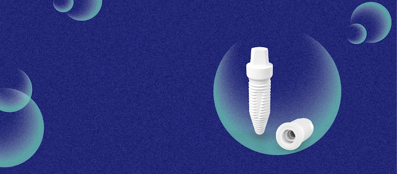 Bioimplantai - odontologijos klinika Kaunas